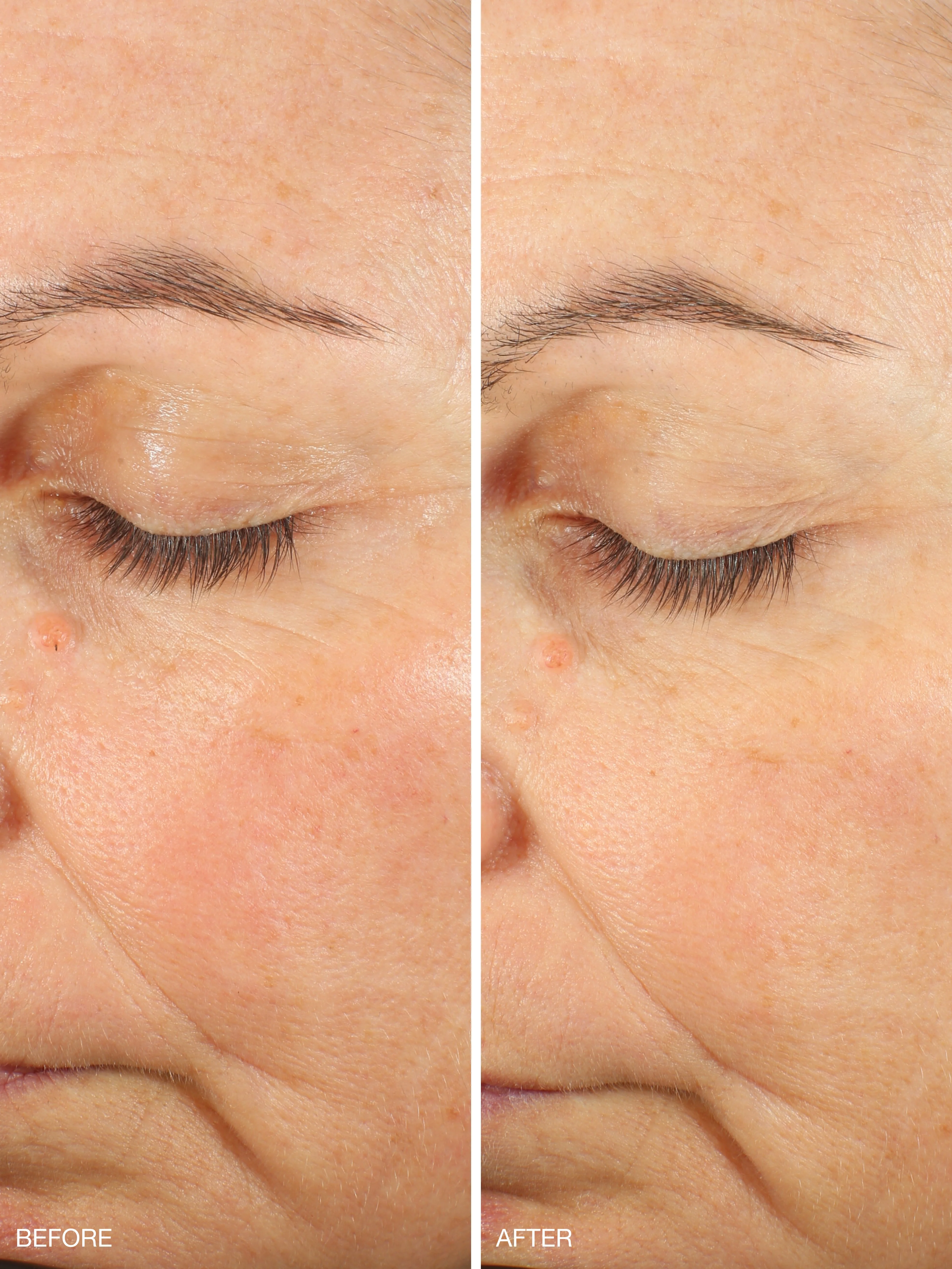 Active Collagen Wonder Serum Refill - Image 5