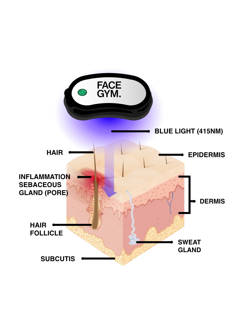 Acne Light Shot - Image 5