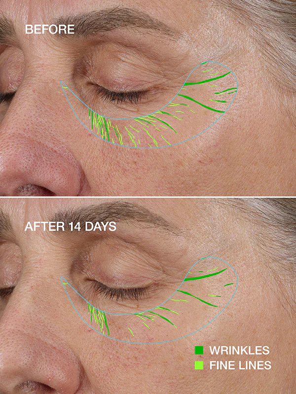 FACEGYM PRO - Image 4
